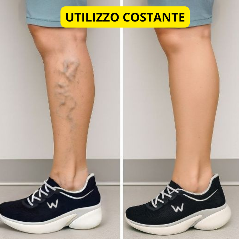 Il sollievo che stavi cercando da tempo - Scarpe Walkstep